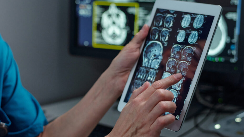 close-up of hands using a tablet to review multiple brain MRI scans, with detailed medical imaging displayed on the screen in a clinical or radiology setting