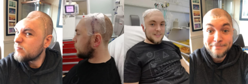 Life After a Brain Injury: Sam’s Story